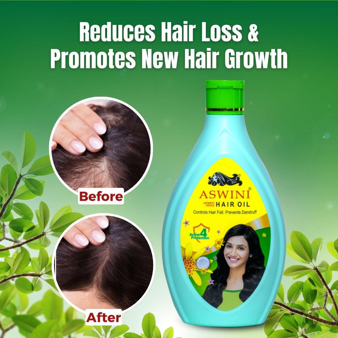 Aswini Homeo Hair Oil - Controls Hair Fall & Dandruff