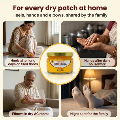 Aswini Calendula Skin Ointment
