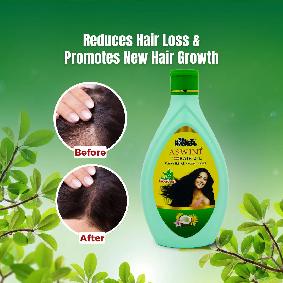 Aswini Homeo Hair Oil - Controls Hair Fall & Dandruff