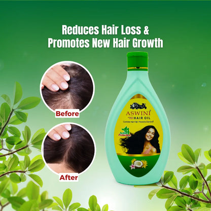 Aswini Homeo Hair Oil - Controls Hair Fall & Dandruff